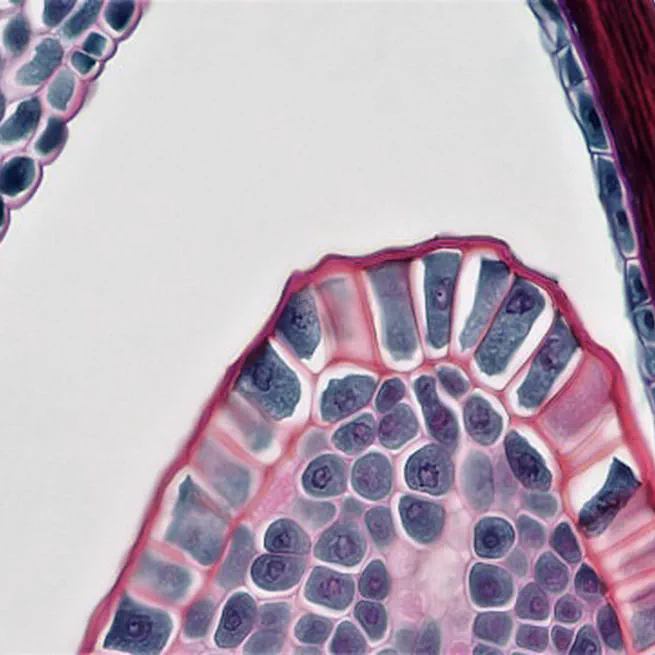 🧬 Train a high-performance Yolov8 (CNN) model for histological analysis: data augmentation and combating overfitting by Active Learning